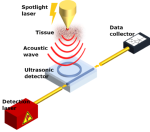 Schematic of a photoacoustic diagnostic tool used in Project REAP. The tool will feature tunable lasers from LioniX.